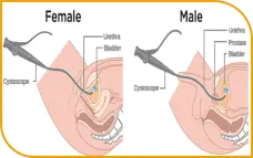 Cystoscopy