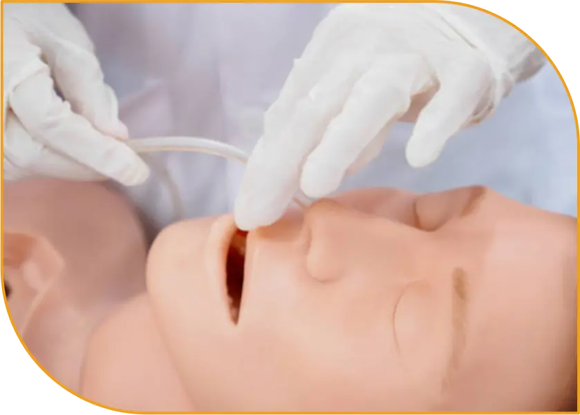 NG Tube Pediatric